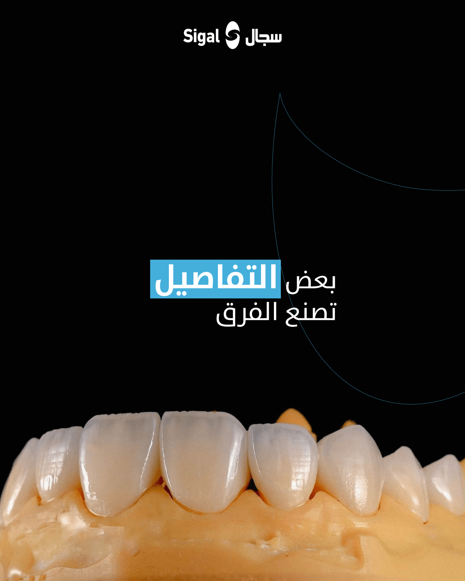 نموذج من أعمال معمل سجال الرقمي للأسنان رقم 2