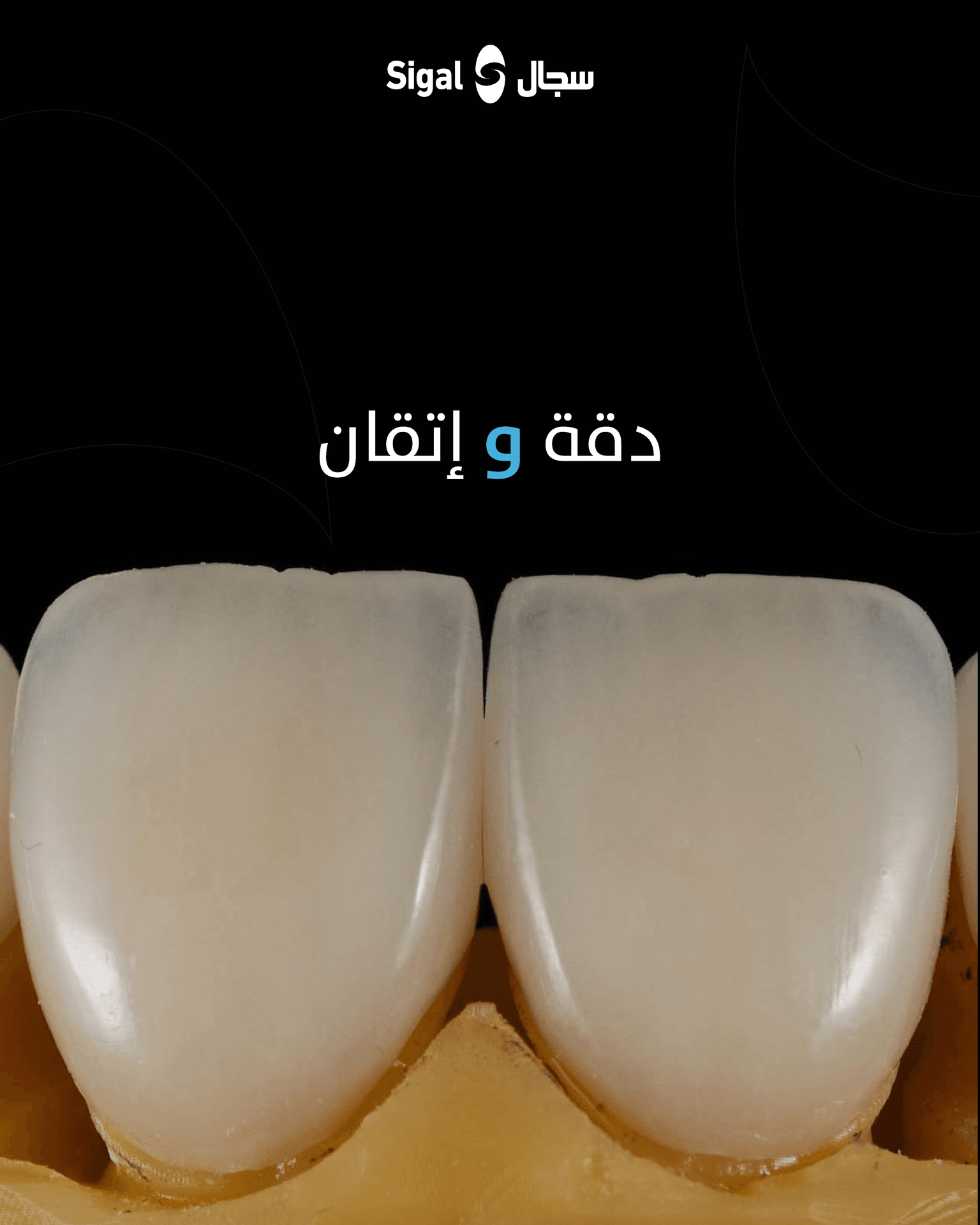 نموذج من أعمال معمل سجال الرقمي للأسنان رقم 7